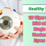 10 Tips to Rid of Bags Under Eyes